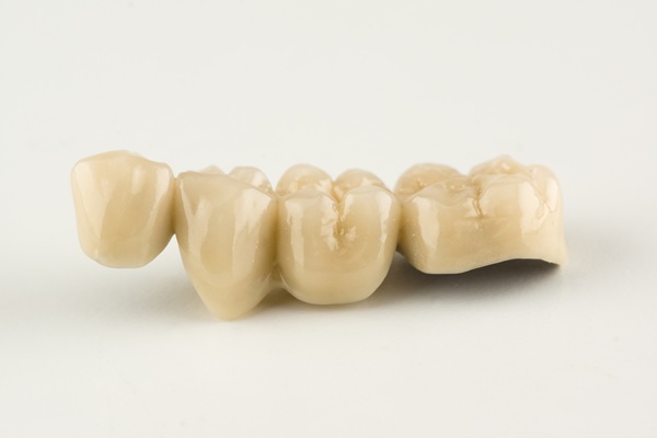 Ways To Take Care Of Your Dental Bridge