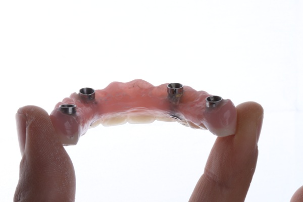 Implant Supported Dentures Procedure Aftercare Tips